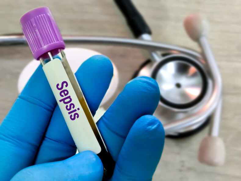 A blue-gloved hand holds a test tube that reads "sepsis"